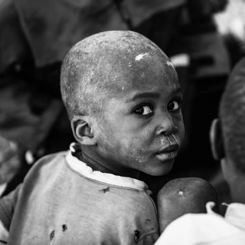 Hope - Photography Winner