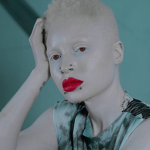 MUSE Photography Awards Silver Winner - I AM UNIQUE by SAVIO JOANES